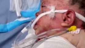 İsrail zulmünün utanç karesi: Gazze'de 10 aylık bebek ağır yaralandı