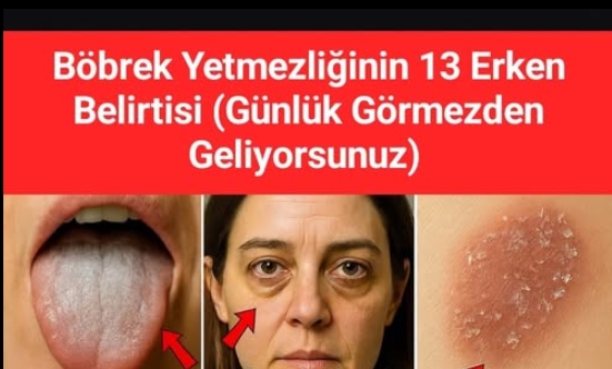 Böbrek Yetmezliğinin 13 Erken Belirtisi!