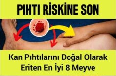 phtıı