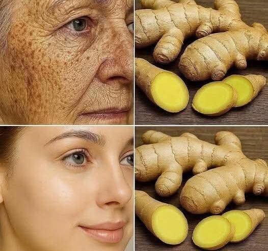 Zencefil Suyunun Sağlığınıza Faydaları