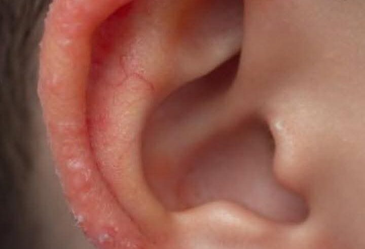 Doktor oğlumun kulağına eğilip bakınca, birden bağırdı